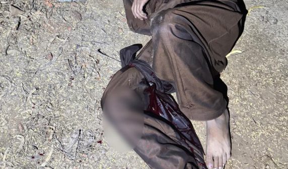 "سرگودھا پولیس مقابلہ، زخمی حالت میں گرفتار ملزم آصف، تھانہ اربن ایریا پولیس کی کارروائی"